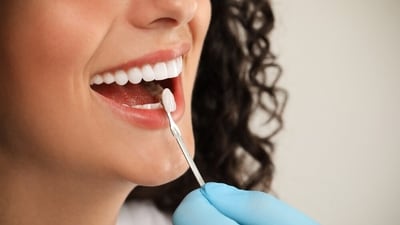 Oral health is particularly crucial in the context of cancer therapy. (Shutterstock) Oral health is particularly crucial in the context of cancer therapy. (Shutterstock)