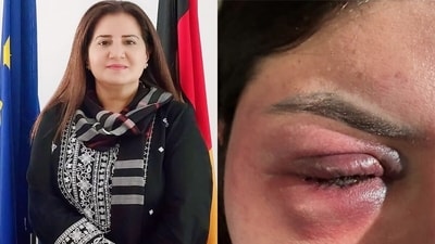 Pakistani TV anchor Jasmeen Manzoor posted bruised images on X. (X/@jasmeenmanzoor) Pakistani TV anchor Jasmeen Manzoor posted bruised images on X. (X/@jasmeenmanzoor)