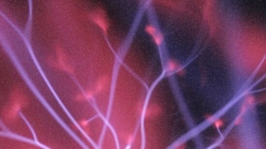 Many companies are looking forward to the possible productivity gains from greater adoption of AI. But there could be a sting in the tail. (Unsplash)