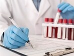 Hs-CRP testing can identify hidden inflammation and predict heart attack risk, especially in individuals without traditional risk factors. Hs-CRP testing can identify hidden inflammation and predict heart attack risk, especially in individuals without traditional risk factors.
