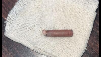 The bullet lodged near the woman’s spine was removed at Civil hospital in Lucknow. (Sourced)