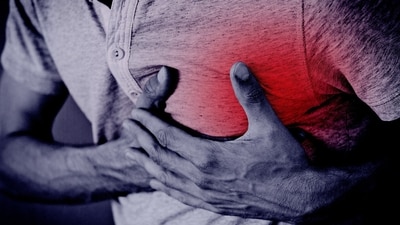 India has one of the highest burdens of cardiovascular disease (CVD) worldwide. (Image by Tumisu from Pixabay ) India has one of the highest burdens of cardiovascular disease (CVD) worldwide. (Image by Tumisu from Pixabay )