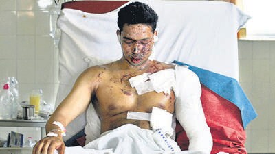 11/7 Mumbai Serial Bomb Blasts - Virar resident, Omkar Tirodkar (26) a victim of the Borivli train blast at Karuna Hospital. HT Photo by MANOJ PATIL. July 12, 2006