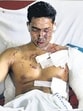 11/7 Mumbai Serial Bomb Blasts - Virar resident, Omkar Tirodkar (26) a victim of the Borivli train blast at Karuna Hospital. HT Photo by MANOJ PATIL. July 12, 2006