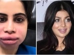 Celebs like Uorfi Javed and Ayesha Takia often spark buzz with their bold beauty transformations and cosmetic tweaks.