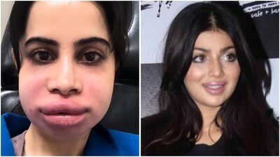 Celebs like Uorfi Javed and Ayesha Takia often spark buzz with their bold beauty transformations and cosmetic tweaks. (Instagram) Celebs like Uorfi Javed and Ayesha Takia often spark buzz with their bold beauty transformations and cosmetic tweaks. (Instagram)