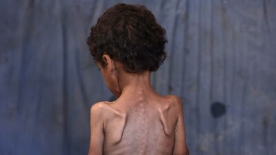 Yazan, a malnourished 2-year-old Palestinian boy, stands with his back turned in his family's damaged home in the Al-Shati refugee camp, west of Gaza City, on July 23, 2025. (AFP) Yazan, a malnourished 2-year-old Palestinian boy, stands with his back turned in his family's damaged home in the Al-Shati refugee camp, west of Gaza City, on July 23, 2025. (AFP)