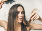 Teenagers are at an increasing risk of hair fall and social media is one of the contributing reasons. 