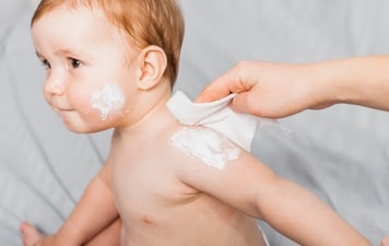 Baby skin is prone to monsoon rashes and infections. (Freepik) Baby skin is prone to monsoon rashes and infections. (Freepik)