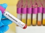 Thalassemia 