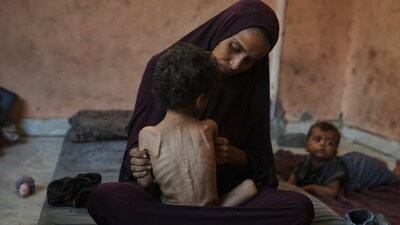 Naima Abu Ful, a Palestinian refugee at the Shati camp in Gaza, with her two-year-old malnourished child, Yazan. (Jehad Alshrafi/AP) Naima Abu Ful, a Palestinian refugee at the Shati camp in Gaza, with her two-year-old malnourished child, Yazan. (Jehad Alshrafi/AP)