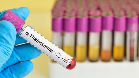 Thalassemia