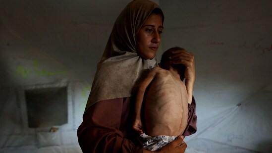 Hidaya, a 31-year-old Palestinian mother, carries her sick 18-month-old son Mohammed al-Mutawaq, who is also displaying signs of malnutrition, inside their tent at the Al-Shati refugee camp, west of Gaza City.(Omar AL-QATTAA/AFP)