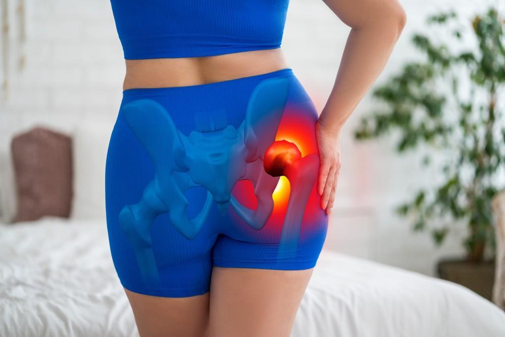 A hip replacement surgery involves removing damaged sections of the hip joint and replacing them. (Shutterstock) A hip replacement surgery involves removing damaged sections of the hip joint and replacing them. (Shutterstock)