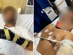 Saurabh Anand suffered stab wounds to his shoulder and back, a fractured spine, multiple broken bones in his arm. Saurabh Anand suffered stab wounds to his shoulder and back, a fractured spine, multiple broken bones in his arm.