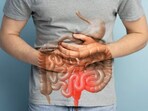 Persistent bloating can signal bowel cancer when tumours partially block the intestine, causing gas and waste to build up. 