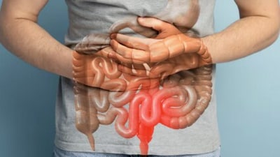 Persistent bloating can signal bowel cancer when tumours partially block the intestine, causing gas and waste to build up. (Freepik) Persistent bloating can signal bowel cancer when tumours partially block the intestine, causing gas and waste to build up. (Freepik)