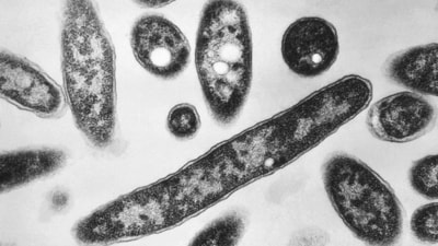Legionnaire's disease is not transmissible, but it can be fatal if left untreated, according to the officer. (AP) Legionnaire's disease is not transmissible, but it can be fatal if left untreated, according to the officer. (AP)