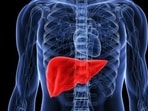 Liver cancer is already a major cause of death and disability. (Representative file photo) Liver cancer is already a major cause of death and disability. (Representative file photo)