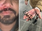 An Indian-origin entrepreneur who claimed he was attacked in Ireland by a group of racist teenagers. An Indian-origin entrepreneur who claimed he was attacked in Ireland by a group of racist teenagers.