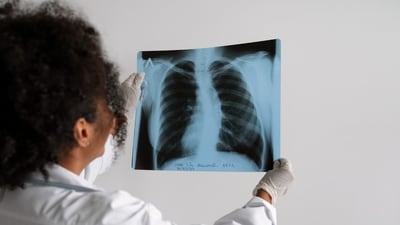 Lung cancer is a type of cancer that starts when abnormal cells grow in an uncontrolled way in the lungs. It is a serious health issue that can cause severe harm and death. (Freepik) Lung cancer is a type of cancer that starts when abnormal cells grow in an uncontrolled way in the lungs. It is a serious health issue that can cause severe harm and death. (Freepik)