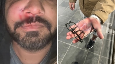 An Indian-origin entrepreneur who claimed he was attacked in Ireland by a group of racist teenagers. (LinkedIn) An Indian-origin entrepreneur who claimed he was attacked in Ireland by a group of racist teenagers. (LinkedIn)