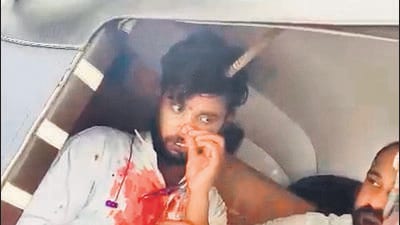 Rod from Metro 5 site falls and pierces head of 20-year-old man in auto Rod from Metro 5 site falls and pierces head of 20-year-old man in auto