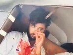 Rod from Metro 5 site falls and pierces head of 20-year-old man in auto