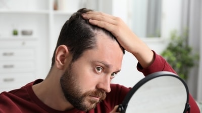 Hairfall indicates serious health conditions, and can be one of the early symptoms. (Shutterstock) Hairfall indicates serious health conditions, and can be one of the early symptoms. (Shutterstock)