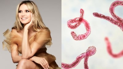 Heidi Klum is hopping on the deworming bandwagon — we asked experts to weigh in