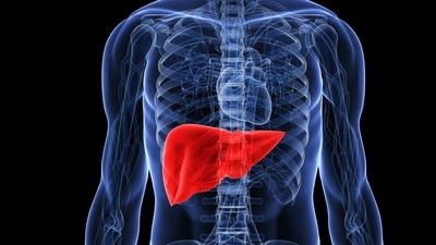 The doctor highlights a concerning increase in liver failure among young adults aged 25 to 35, with a particular focus on alcohol-related liver disease. (Twitter/AHealthyBod) The doctor highlights a concerning increase in liver failure among young adults aged 25 to 35, with a particular focus on alcohol-related liver disease. (Twitter/AHealthyBod)