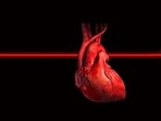The cardiologist explained how minimally invasive procedures like MitraClip and TriClip offer promising solutions for patients with leaky heart valves. (Representative image) The cardiologist explained how minimally invasive procedures like MitraClip and TriClip offer promising solutions for patients with leaky heart valves. (Representative image)
