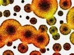Antibiotic resistance occurs when bacteria evolve to resist the effects of antibiotics, making infections harder to treat and increasing the risk of disease spread, severe illness, and death. Antibiotic resistance occurs when bacteria evolve to resist the effects of antibiotics, making infections harder to treat and increasing the risk of disease spread, severe illness, and death.