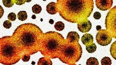 Antibiotic resistance occurs when bacteria evolve to resist the effects of antibiotics, making infections harder to treat and increasing the risk of disease spread, severe illness, and death. (Shutterstock/HT Archive) Antibiotic resistance occurs when bacteria evolve to resist the effects of antibiotics, making infections harder to treat and increasing the risk of disease spread, severe illness, and death. (Shutterstock/HT Archive)