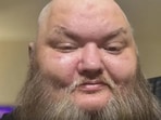 TikToker John Crawley died on Monday TikToker John Crawley died on Monday