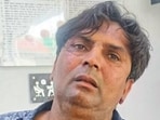 The attacker, 41-year-old Sakriya Rajeshbhai Khimjibhai, a resident of Rajkot, was arrested by the Delhi police. The attacker, 41-year-old Sakriya Rajeshbhai Khimjibhai, a resident of Rajkot, was arrested by the Delhi police.