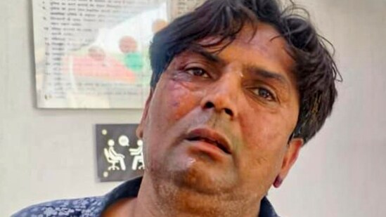 Rajesh Bhai Khimji, accused of attacking Delhi chief minister Rekha Gupta, after being detained by the police in New Delhi on Wednesday. (PTI)
