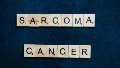 Sarcomas are cancers that develop in the connective tissues of the body, such as bones, fat, nerves, and blood vessels. Sarcomas are cancers that develop in the connective tissues of the body, such as bones, fat, nerves, and blood vessels.