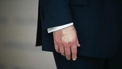 President Trump's hand is seen as he speaks at "The People's House" (AFP) President Trump's hand is seen as he speaks at "The People's House" (AFP)