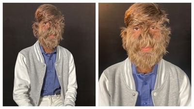 18-year-old Lalit Patidar holds the record for the hairiest face on a male. (PC: Guinness World Records) 18-year-old Lalit Patidar holds the record for the hairiest face on a male. (PC: Guinness World Records)