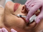 The woman was taken to the plastic surgery clinic by the owner of a therapy centre in her residential compound. (Representational image). The woman was taken to the plastic surgery clinic by the owner of a therapy centre in her residential compound. (Representational image).