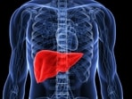 Bangalore man's liver fails after daily use of 'natural' herbal detox tonic. 