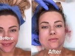 Woman reflects on social media's influence on beauty standards after cosmetic surgery misstep. 
