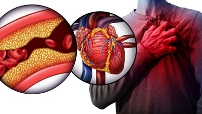 Just one serving a day of sugar is linked to an 18 percent higher heart disease risk. Two or more? 21 percent higher – even in people who work out.” (Shutterstock) Just one serving a day of sugar is linked to an 18 percent higher heart disease risk. Two or more? 21 percent higher – even in people who work out.” (Shutterstock)