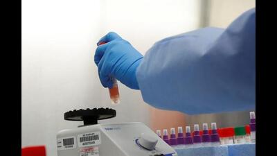 MSU is a special unit with laboratory facility aimed at understanding the nature and cause of diseases in an urban context and identifying potential disease outbreaks. (REPRESENTATIVE PHOTO) MSU is a special unit with laboratory facility aimed at understanding the nature and cause of diseases in an urban context and identifying potential disease outbreaks. (REPRESENTATIVE PHOTO)