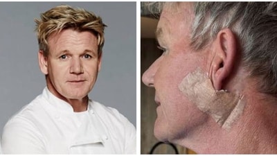 Gordon Ramsay shared that he has been diagnosed with skin cancer. Gordon Ramsay shared that he has been diagnosed with skin cancer.