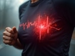 What someone who is not a doctor should do in case they see a person, without immediate medical assistance available, having a heart attack. What someone who is not a doctor should do in case they see a person, without immediate medical assistance available, having a heart attack.