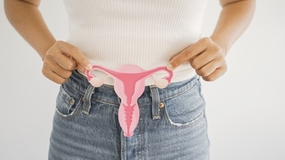 PCOS in adolescents has seen a disturbing steep increase. (Shutterstock) PCOS in adolescents has seen a disturbing steep increase. (Shutterstock)