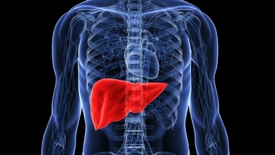 Dr. Mehta highlights a worrying increase in liver cancer cases among young non-drinkers. Dr. Mehta highlights a worrying increase in liver cancer cases among young non-drinkers.