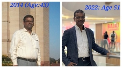 Dr. Kumar cut down his work hours to 8-9 hours a day, allowing for more time to focus on his health. (X/ Hyderabad Doctor) Dr. Kumar cut down his work hours to 8-9 hours a day, allowing for more time to focus on his health. (X/ Hyderabad Doctor)